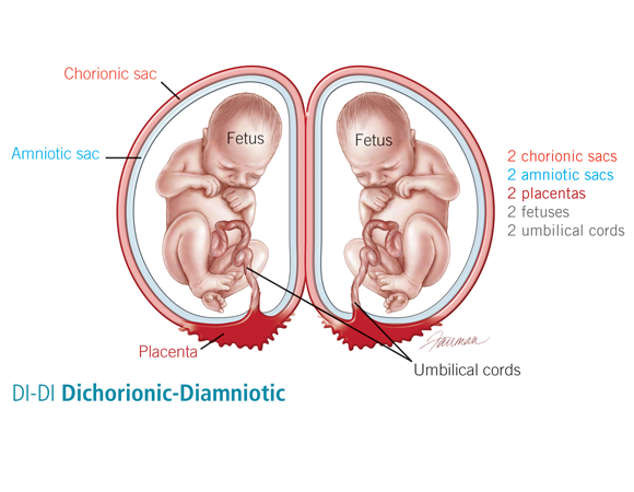 Image via Brigham and Women's Hospital