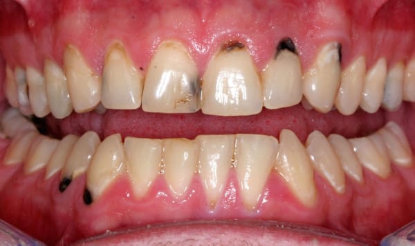 Image via Vermont Dentistry
