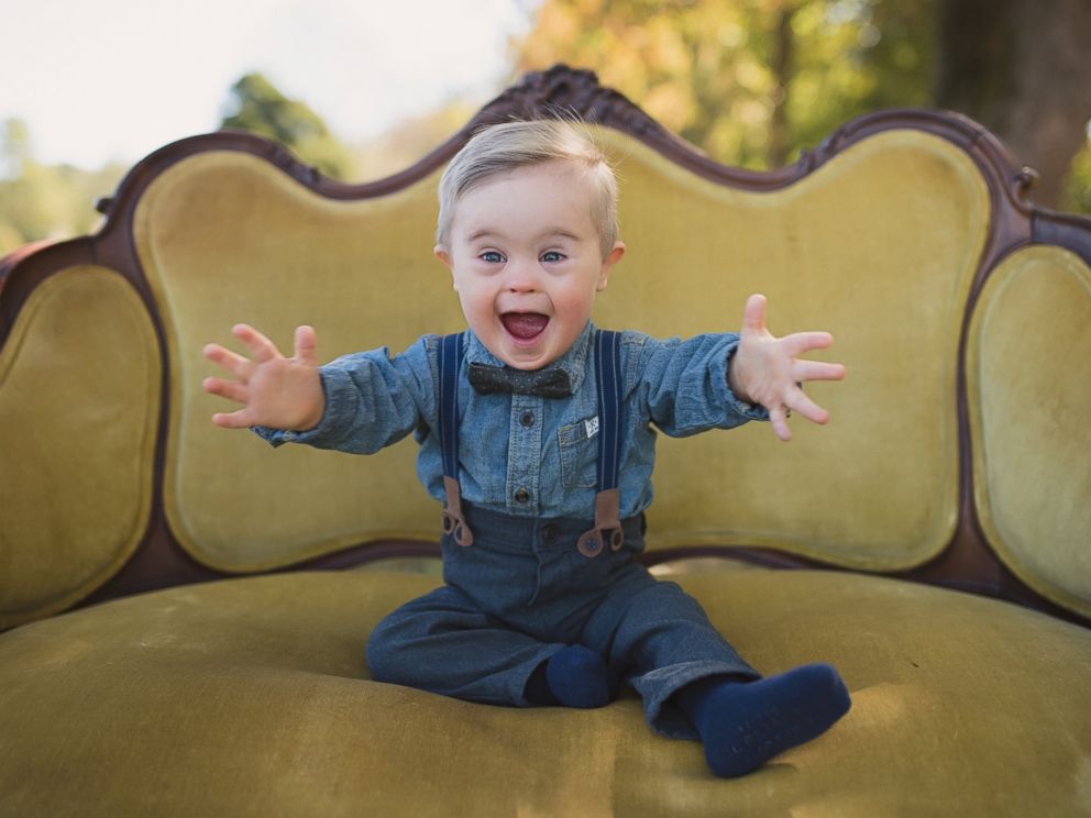 gerber baby with downs