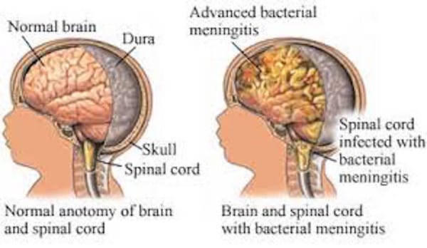 Image via Your Health Educator