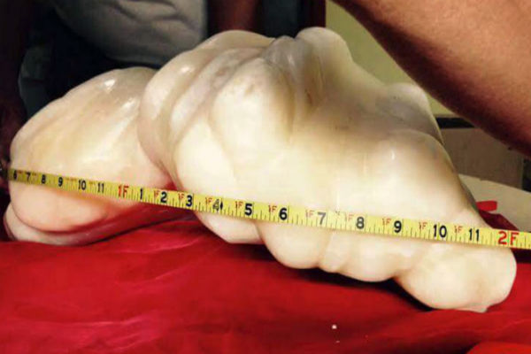 Image via New York Post 