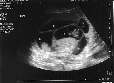 Image via WilkinsonQuints.org