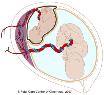 Cincinnati Children's Hospital
