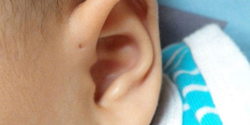 世界人口の1 だけが持っているらしい 耳の横にある穴 の正体は Hachibachi
