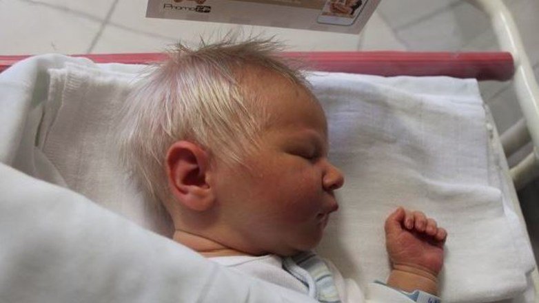 Baby Born With Silver Hair Due To Rare Condition That Causes Pigment Shortage In Hair Small Joys