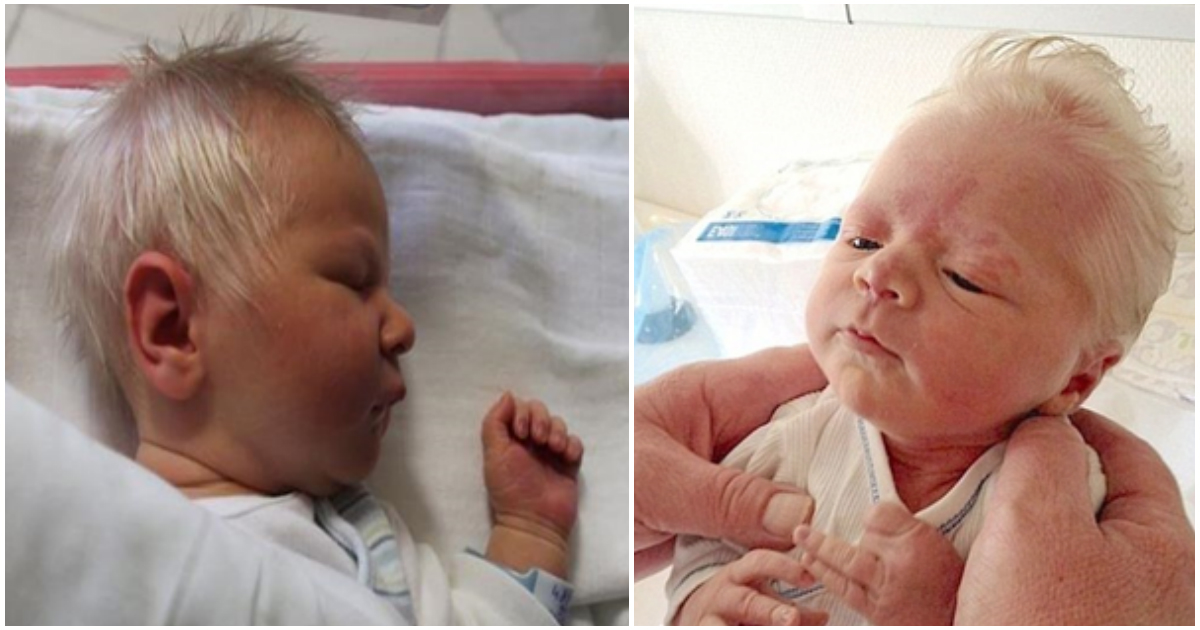 Baby Born With Silver Hair Due To Rare Condition That Causes