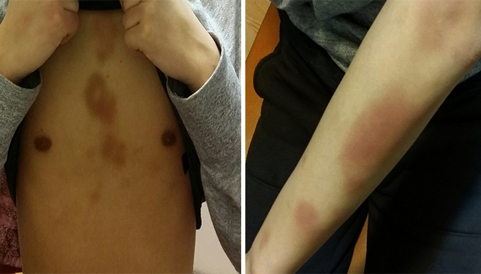 SBS '궁금한 이야기 Y'