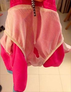 childs-penis-was-caught-in-shorts-on-holiday