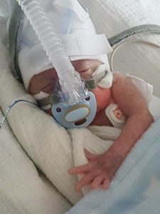 swns_premature_baby_025