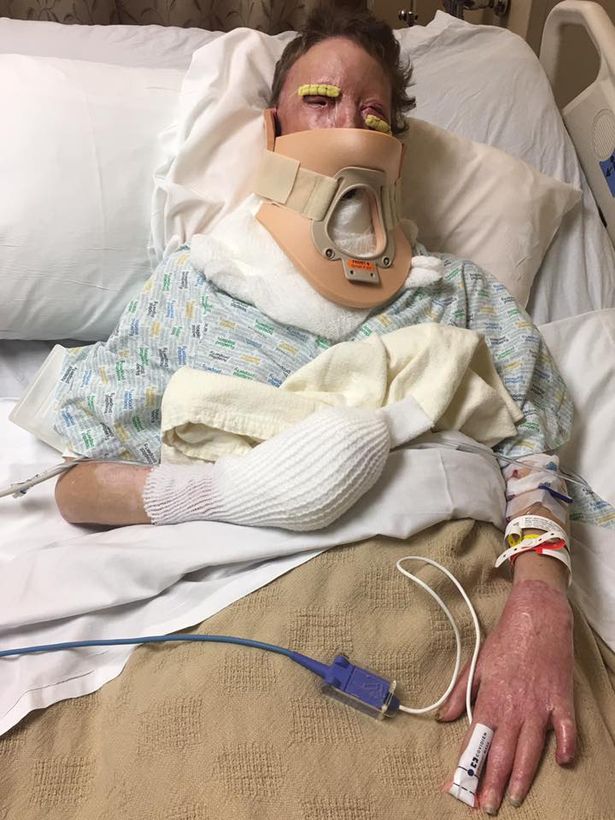 The road to recovery for Courtney has been tough. Image via YouTube.