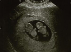 697e74f5137e105655852698c48c9ad9