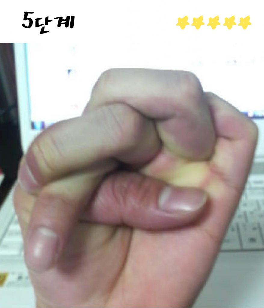 %ec%86%90%ea%b0%80%eb%9d%bd-05