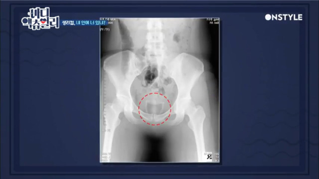 온스타일 '바디 액츄얼리'