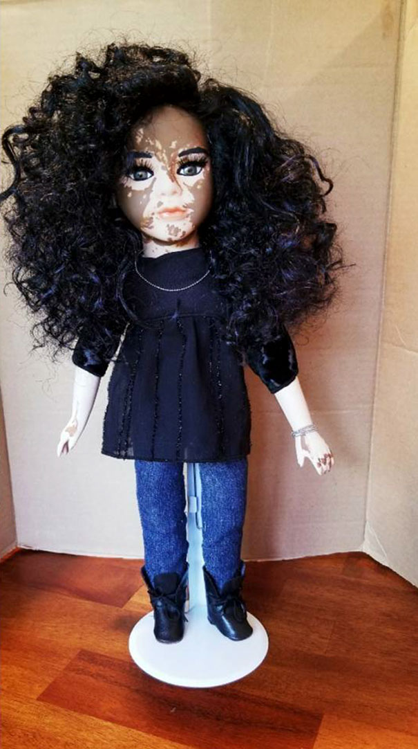 designer-creates-dolls-with-vitiligo-so-that-children-start-to-live-with-differences-in-childhood-59ca0e81aa66a__605
