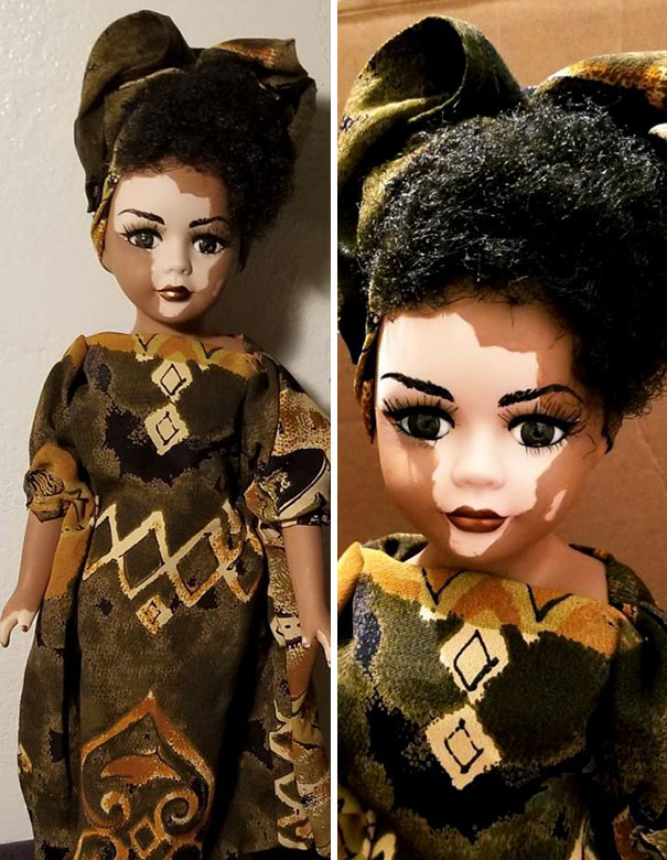 designer-creates-dolls-with-vitiligo-so-that-children-start-to-live-with-differences-in-childhood-59ca0e84068d2__605