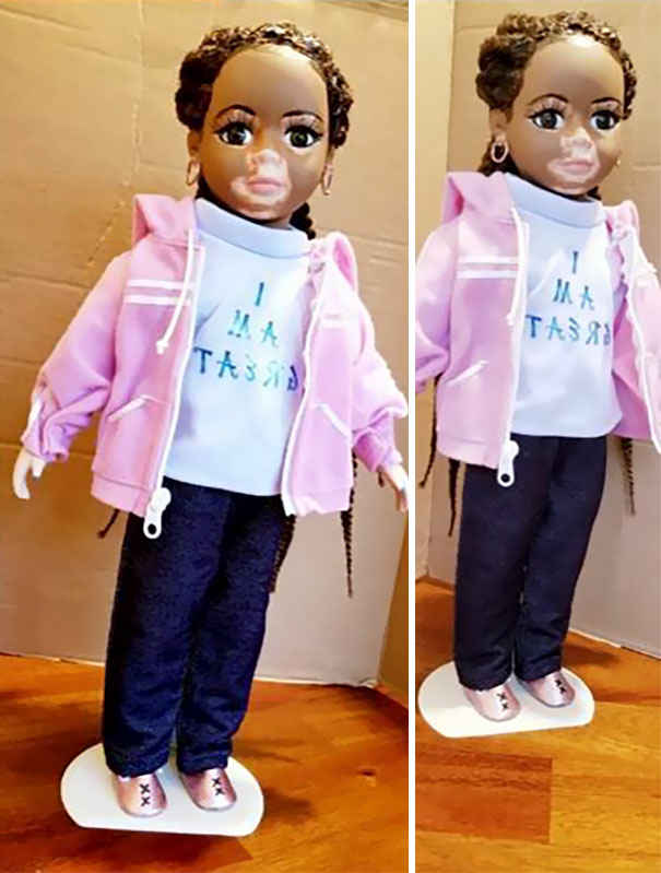 designer-creates-dolls-with-vitiligo-so-that-children-start-to-live-with-differences-in-childhood-59ca0e8bf2899__605