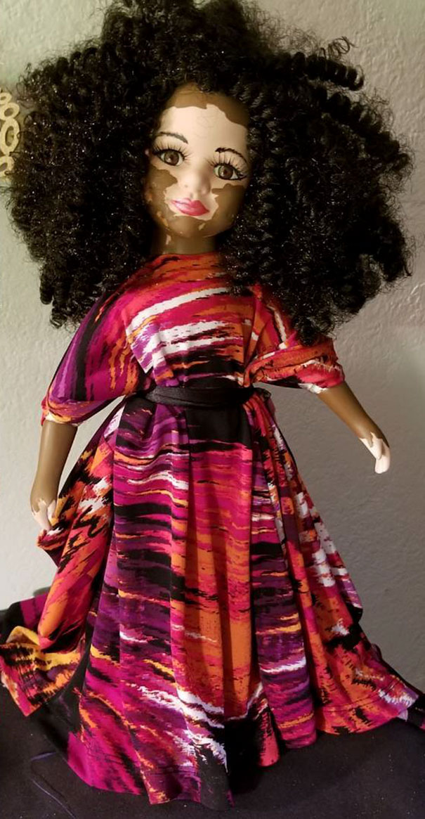 designer-creates-dolls-with-vitiligo-so-that-children-start-to-live-with-differences-in-childhood-59ca0e910df5b__605
