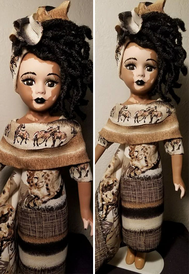 designer-creates-dolls-with-vitiligo-so-that-children-start-to-live-with-differences-in-childhood-59ca0e97304cc__605