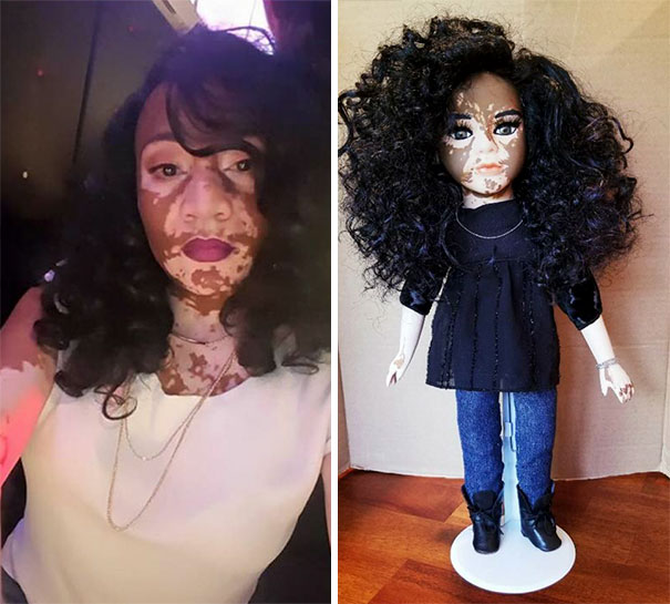 designer-creates-dolls-with-vitiligo-so-that-children-start-to-live-with-differences-in-childhood-59ca14a01a8d1__605