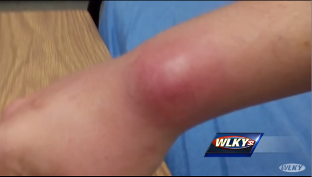 Youtube 'WLKY News'