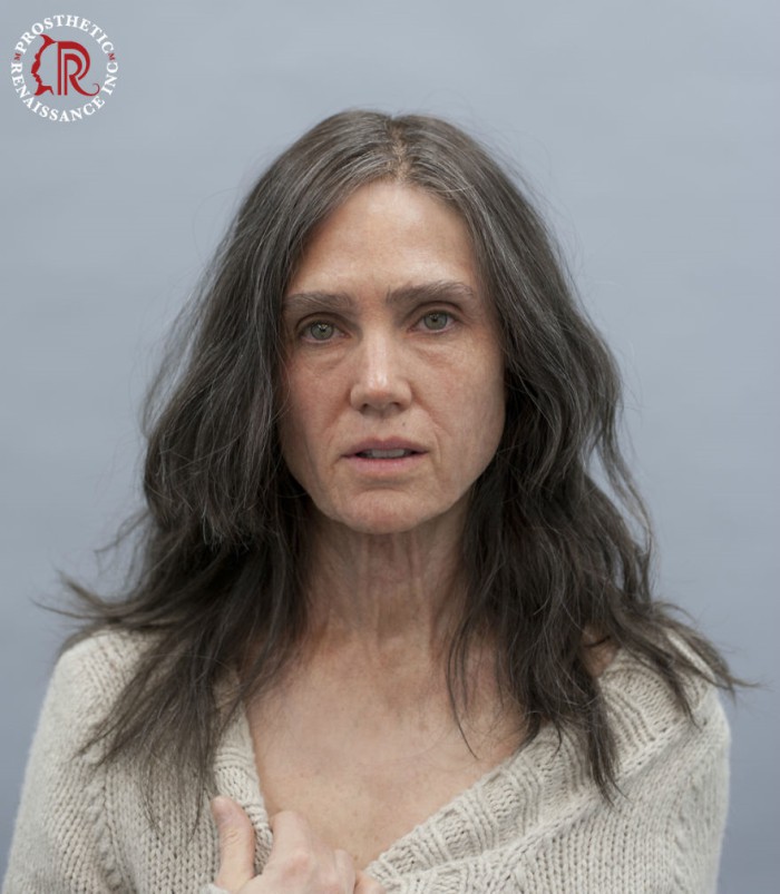 Prosthetic Renaissance