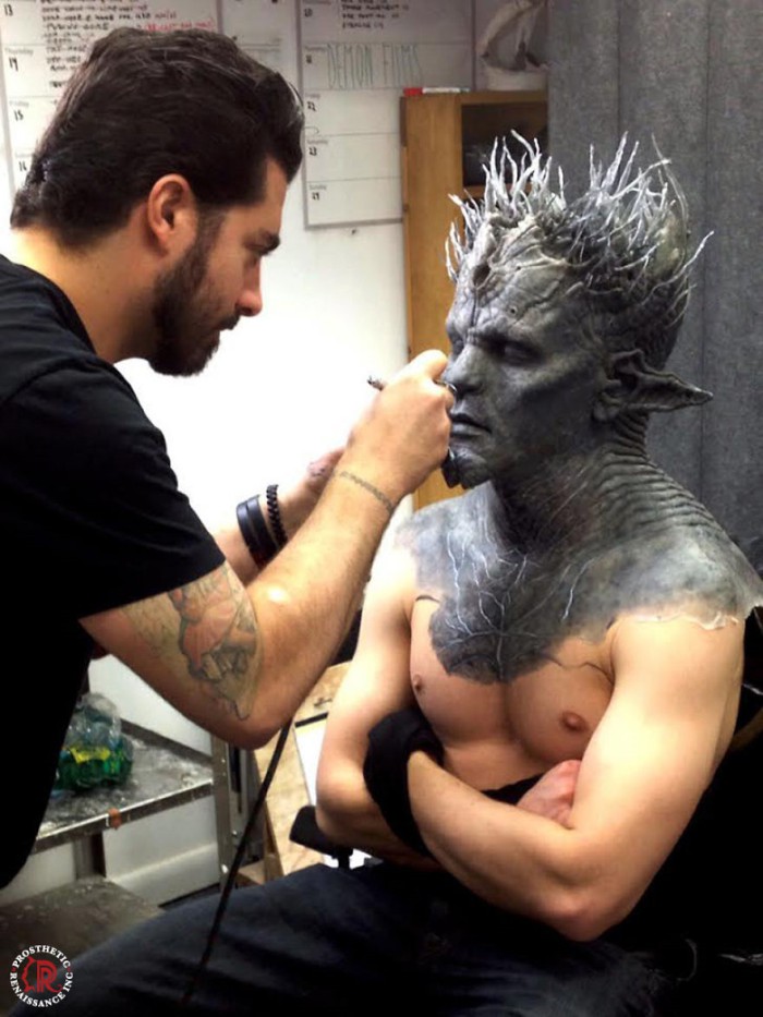 Prosthetic Renaissance