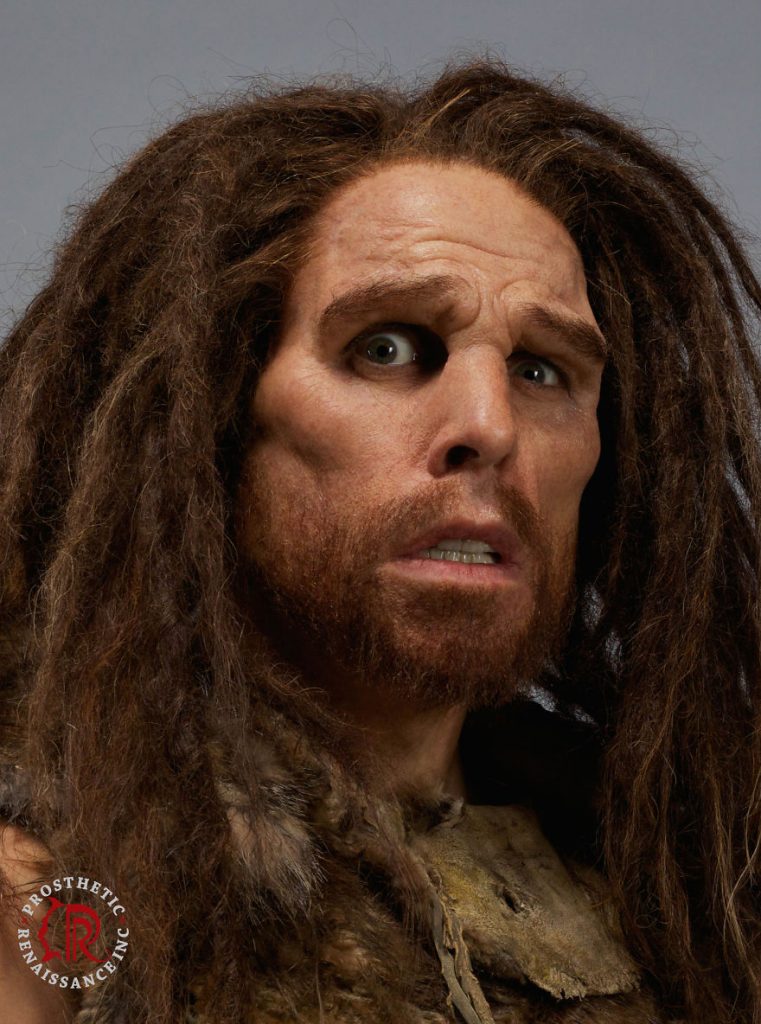 Prosthetic Renaissance