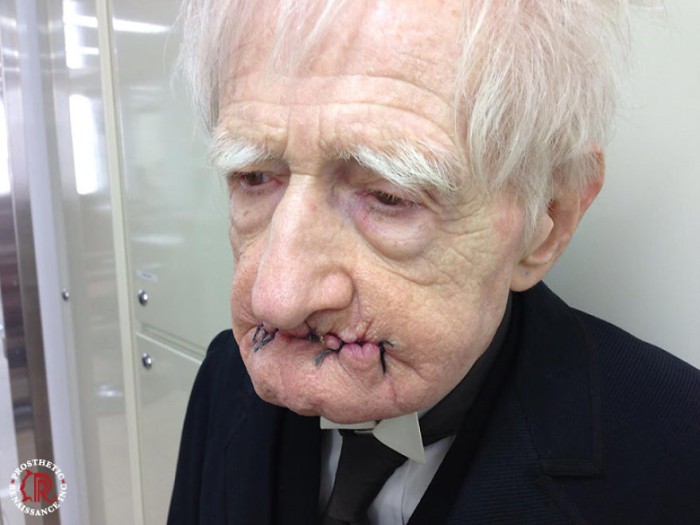 Prosthetic Renaissance