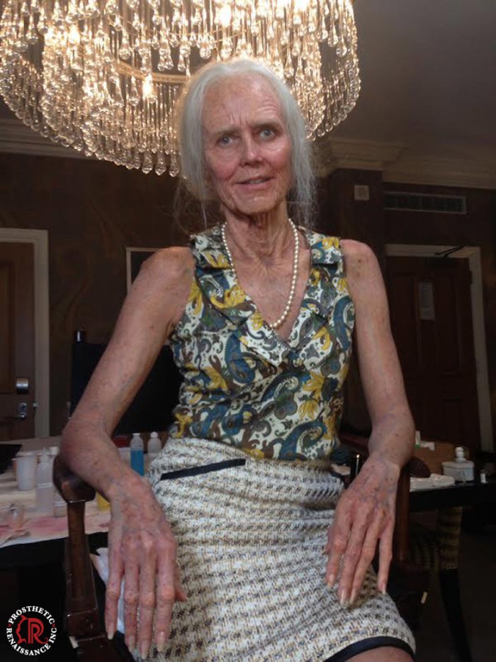 Prosthetic Renaissance