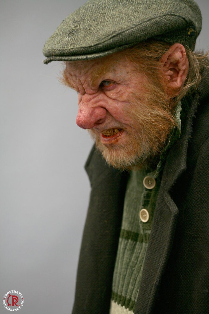 Prosthetic Renaissance