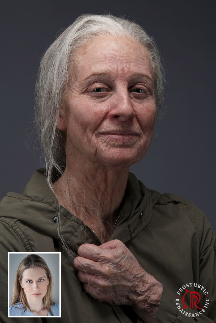 Prosthetic Renaissance