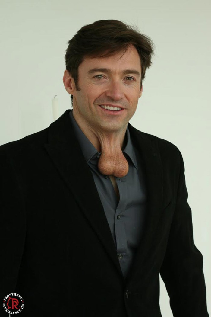 Prosthetic Renaissance