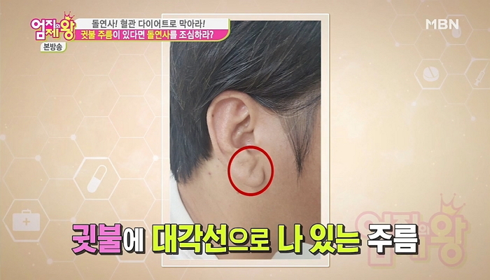 MBN '엄지의 제왕' 