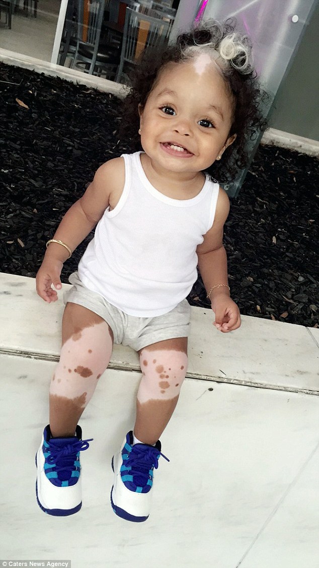 3a2410de00000578-3912394-condition_millianna_s_mum_brianna_says_she_grew_to_love_her_own_-a-8_1478513384788