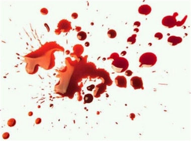 手のひら 血에 대한 이미지 검색결과