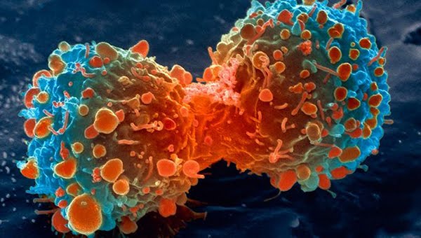 ©cancer.gov