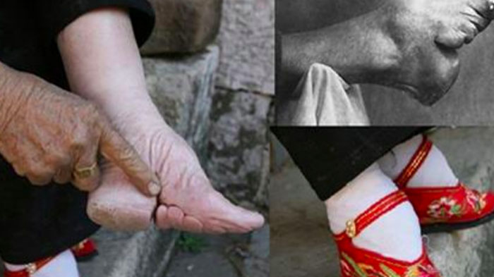 The Last Woman To Follow China S Year Old Foot Binding Tradition Shows The Damage Done