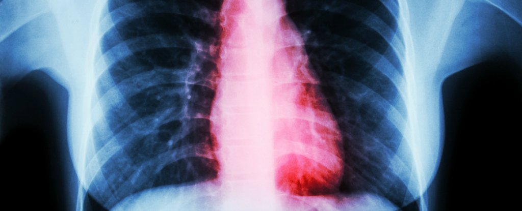 Image result for A Clinical Broken Heart