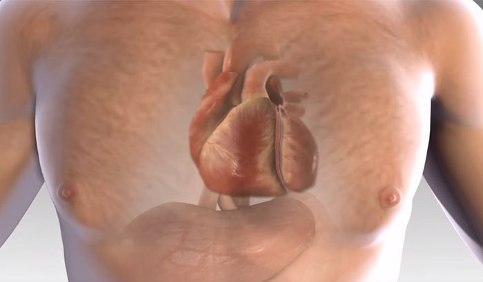 heartattackwarnings2