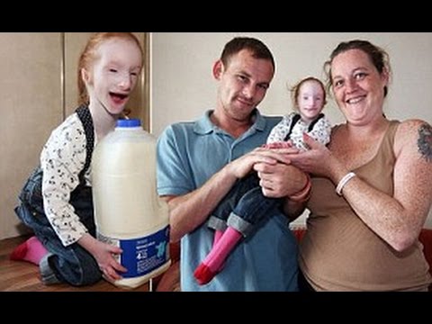 World's Smallest Girl Charlotte Continues To Defy All Medical Odds mom delivers doll like baby 2 - World's Smallest Girl Charlotte Continues To Defy All Medical Odds