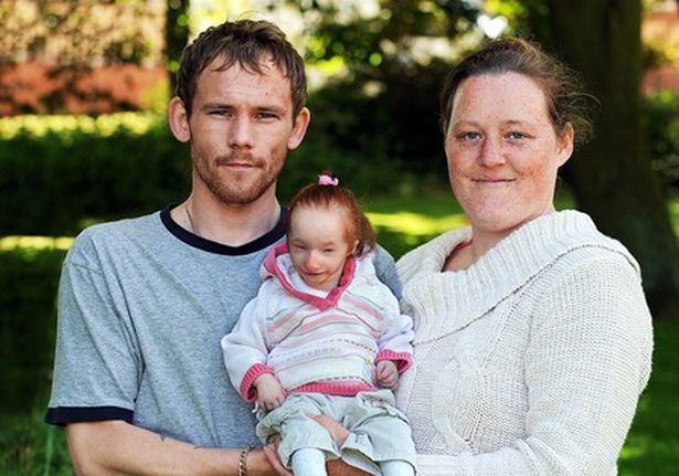 World's Smallest Girl Charlotte Continues To Defy All Medical Odds mom delivers doll like baby 4 - World's Smallest Girl Charlotte Continues To Defy All Medical Odds