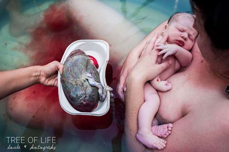professional-birth-photography-competition-winners-labor-2017-36-58b02bea5a170__880-2