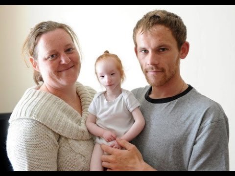 World's Smallest Girl Charlotte Continues To Defy All Medical Odds tiniest girl in the world 5a14561c82a5c - World