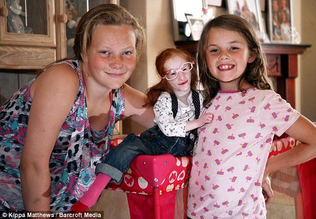World's Smallest Girl Charlotte Continues To Defy All Medical Odds tiniest girl in the world 5a1456239f0ec - World