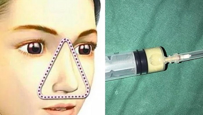 Guangzhou Daily / Sina