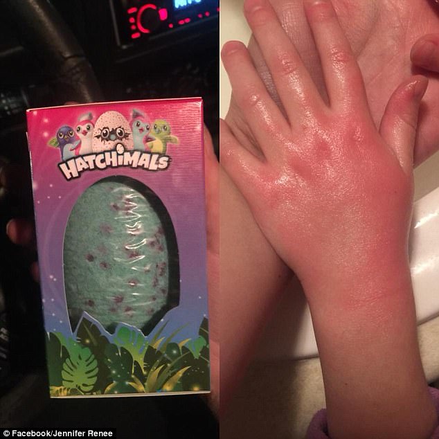 475ce36f00000578-5183889-jennifer_renee_said_the_hatchimals_bath_bombs_left_chemical_burn-a-27_1513355064344