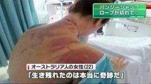 バンジージャンプの事故原因は 安全性は大丈夫 Hachibachi