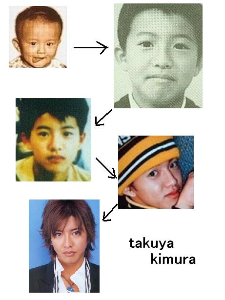 木村拓哉 整形에 대한 이미지 검색결과