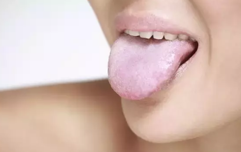 Image result for 舌　白