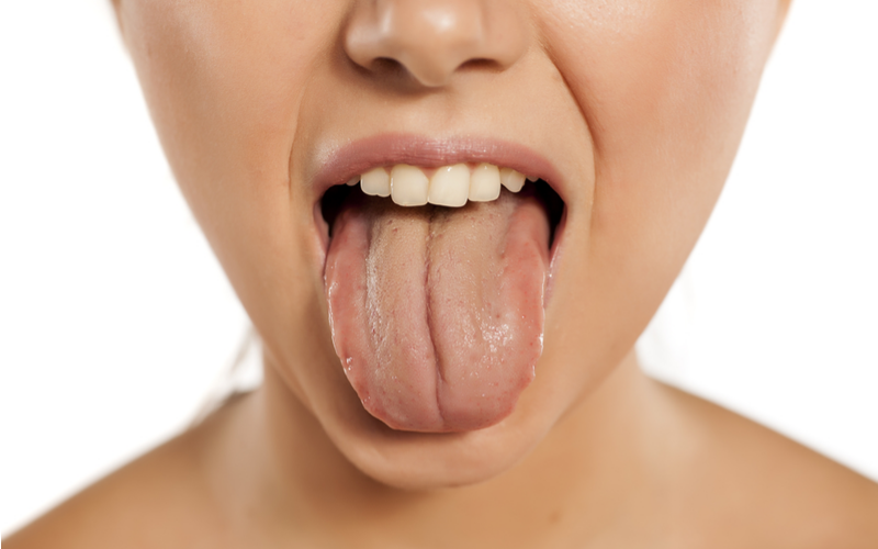 Image result for 舌　黄色